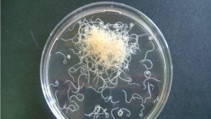 HOY POR HOY ZARAGOZA Y LA CIENCIA: ANISAKIS Y TOXOPLASMA (08/10/25)