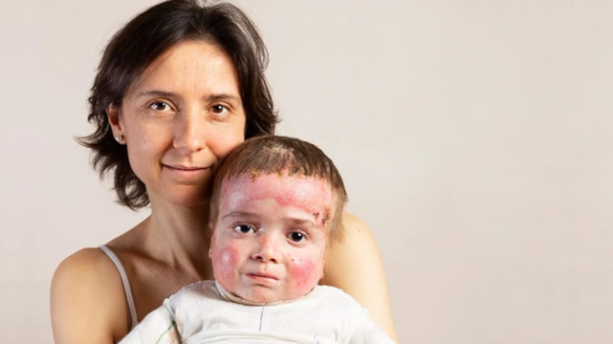 Evanina Morcillo, presidenta de Debra Piel de Mariposa