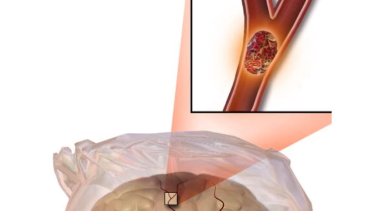 Entrevista Ana Morales