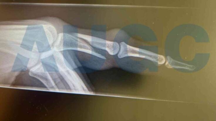 Nueva agresión a un guardia civil en el Aeropuerto de Lanzarote