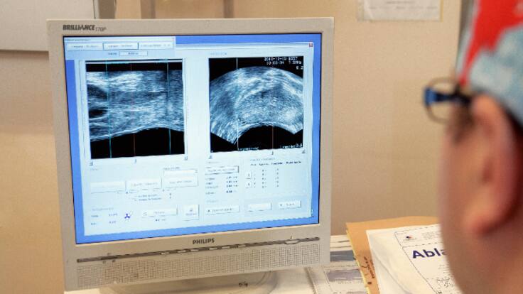 Eva Redondo, técnico en prevención de la AECC: "El 90% de los casos de cáncer de próstata se diagnostica en mayores de 65 años"