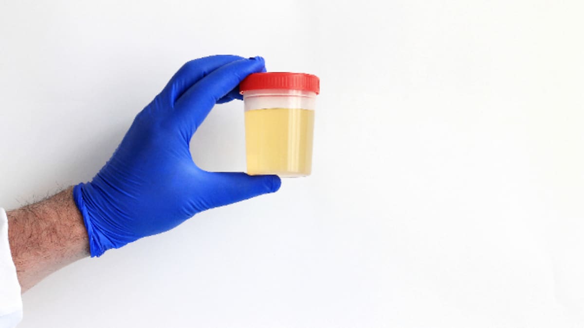 Un nefrólogo señala el síntoma que puede indicar que sufrimos una enfermedad renal: no, no es el color de la orina