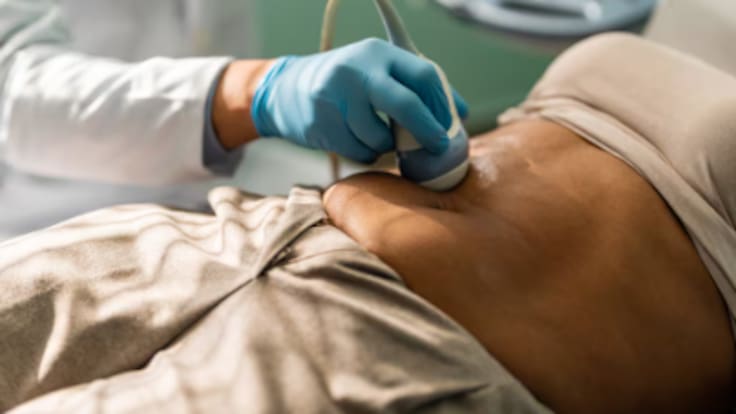 El científico Mariano Barbacid logra eliminar el cáncer de páncreas más común en modelos animales