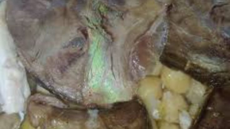 Finaliza la huelga de hambre de Marcelo