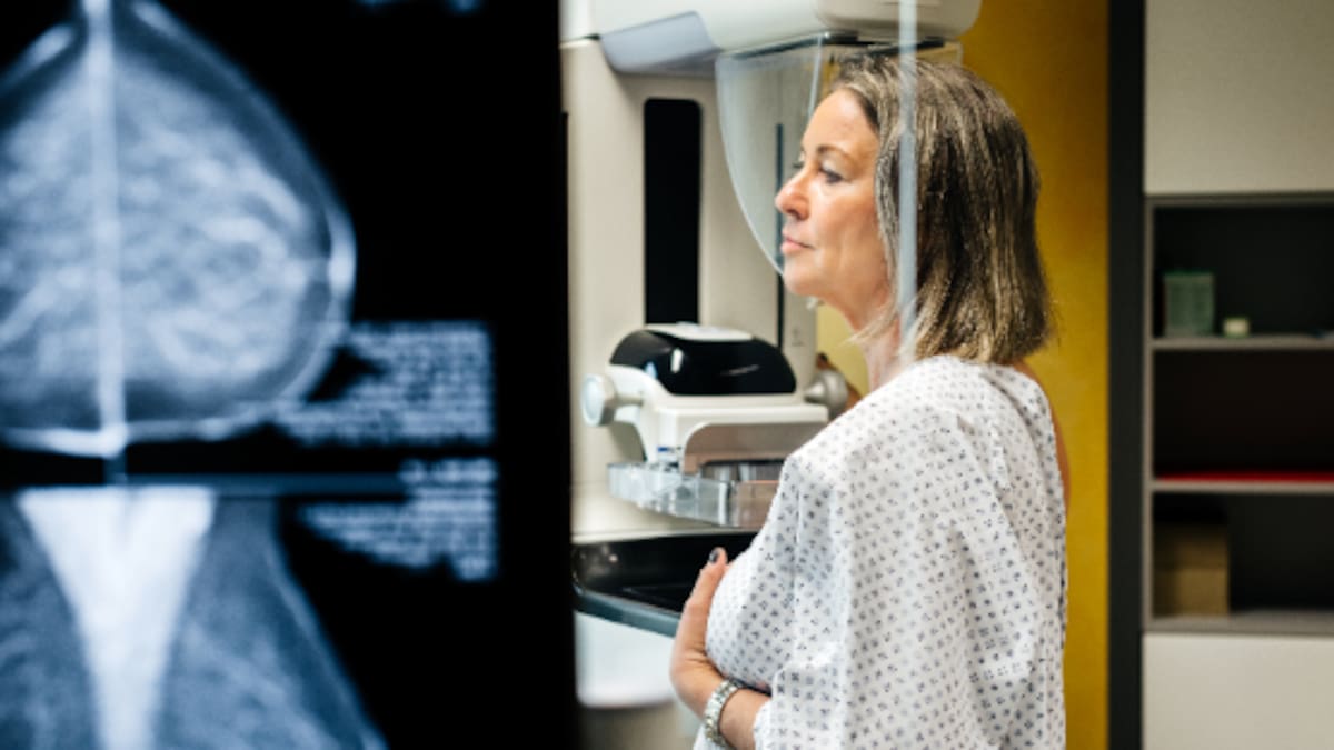 Del "mamobús" en la plaza del pueblo a la mamografía de hospital: esta es la historia del cribado de cáncer