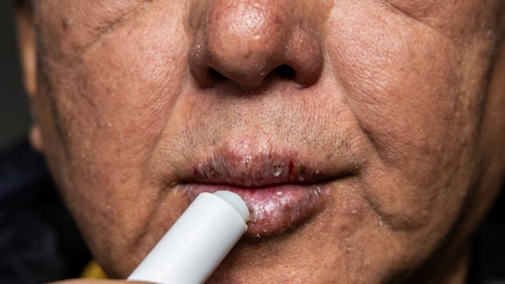 La Rebotica: Cómo cuidar las manos y los labios en invierno