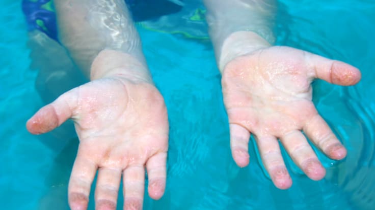 ¿Por qué se nos arrugan los dedos en la piscina? La ciencia explica el "efecto neumático" de nuestras manos