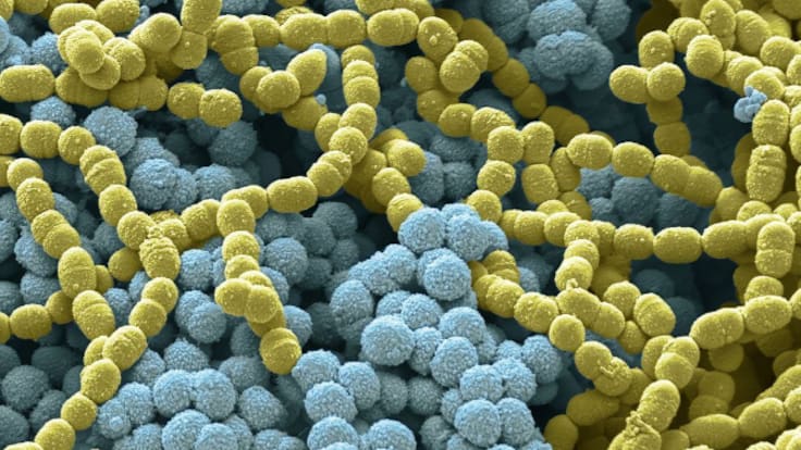 Probióticos vs prebióticos: cuál es la diferencia