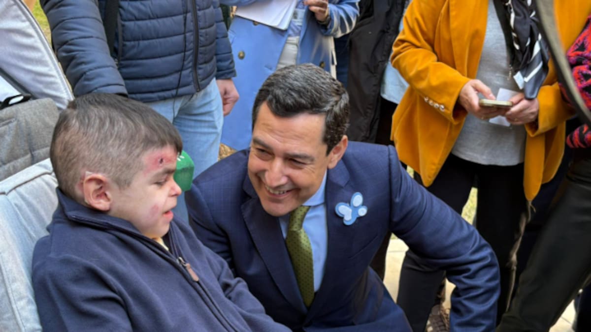 "Nos va a librar de este dolor", Leo, el niño de 12 años afectado por piel de mariposa