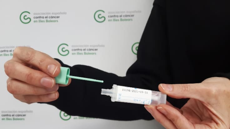 Hoy por Hoy SER de Huesca- Prevención del Cáncer de colon