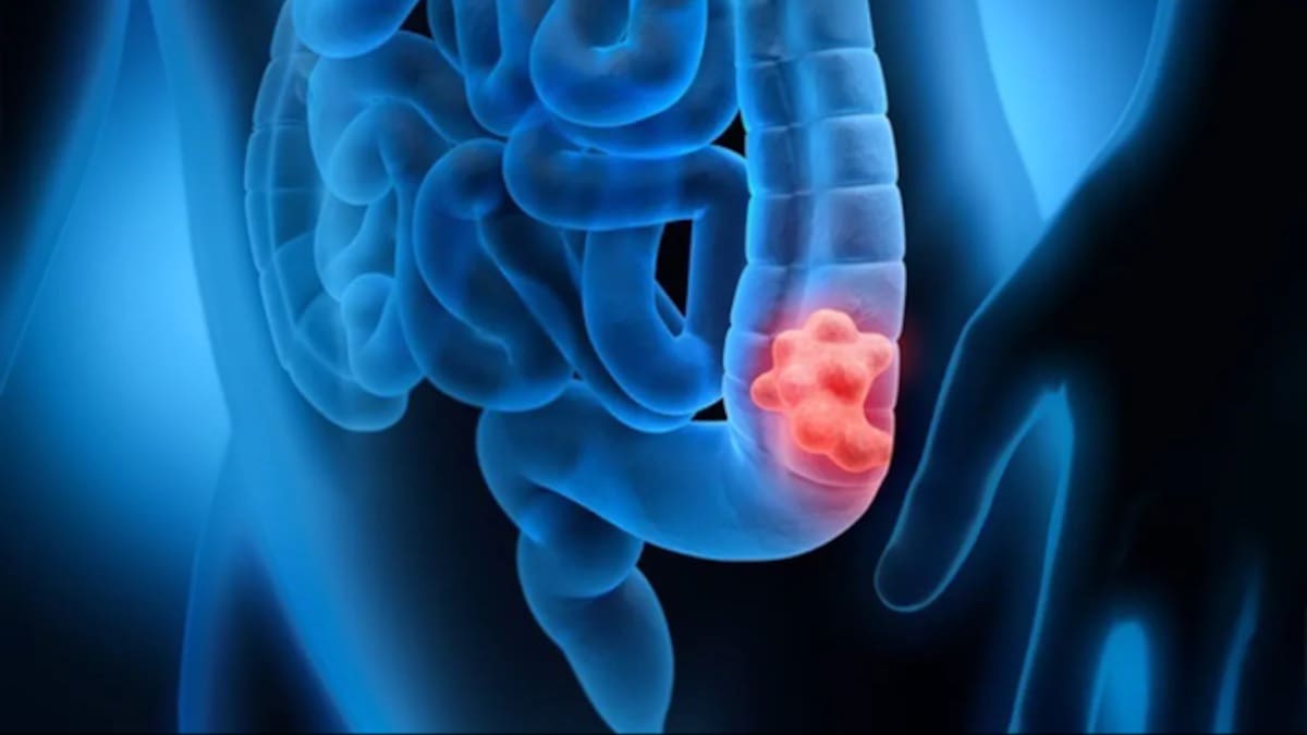 Entrevista Iria Villar Cancela