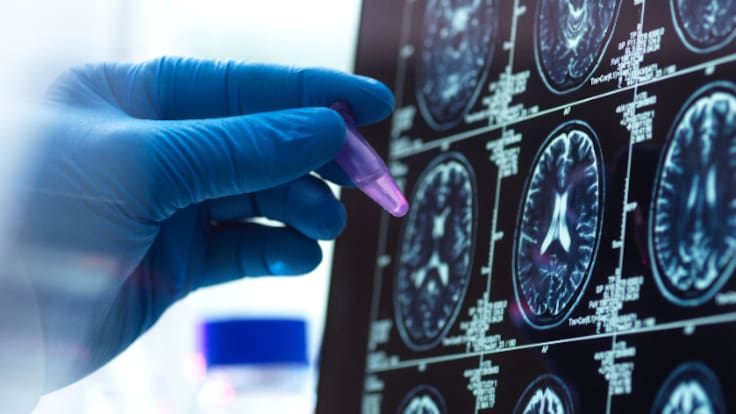 Un grupo de neurocientíficos crea minicerebros humanos y abren un dilema: "¿Podrán pensar?"